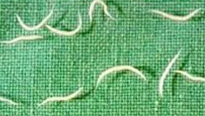 Gambar cacing kremi